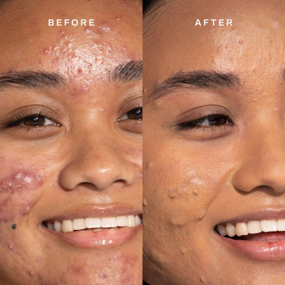 Everyday Base-ics Set